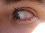 Michael’s eye on the lookout for the bus